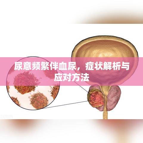 尿意频繁伴血尿，症状解析与应对方法