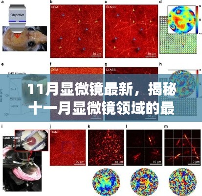 揭秘十一月显微镜领域的最新进展与突破