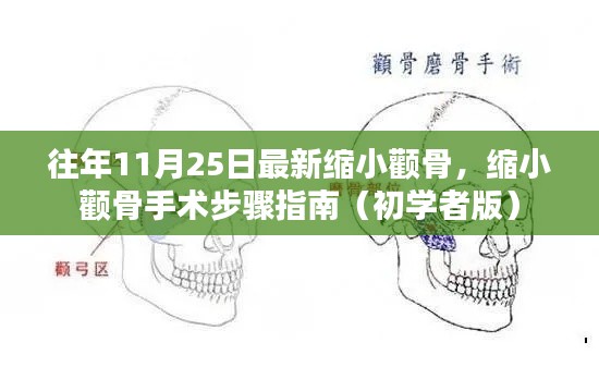 初学者指南，缩小颧骨手术步骤详解，历年经验总结助你轻松应对手术挑战