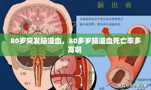 80岁突发脑溢血，80多岁脑溢血死亡率多高啊 