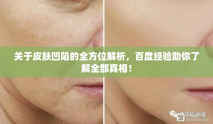 关于皮肤凹陷的全方位解析，百度经验助你了解全部真相！